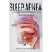 Sleep Apnea: A Profound Guide to Sleep Well and Feel Better