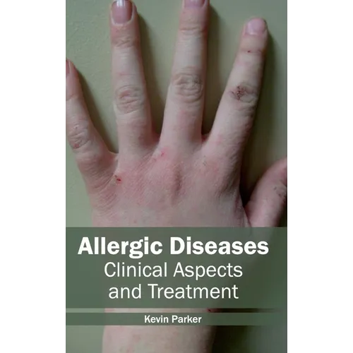 Allergic Diseases: Clinical Aspects and Treatment