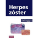 Herpes zóster