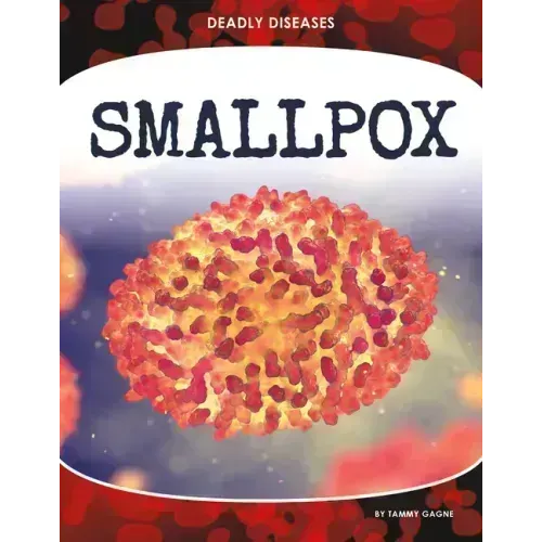 Smallpox