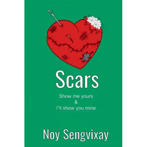 Scars