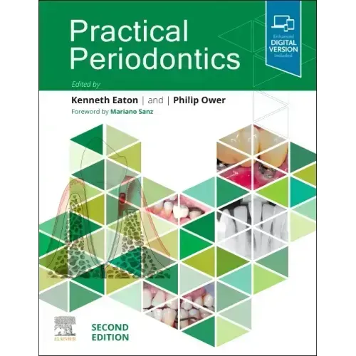 Practical Periodontics