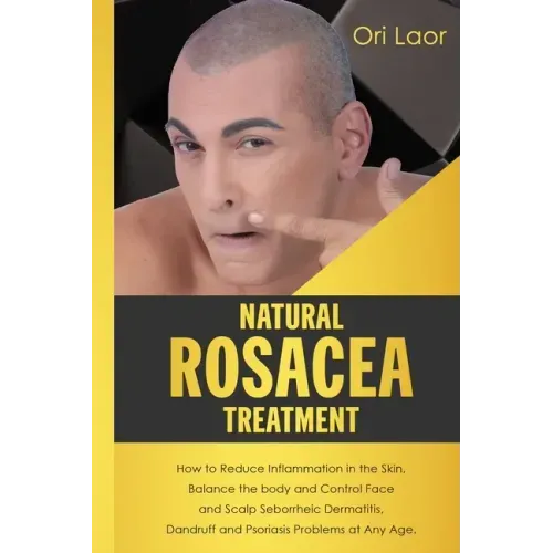 Natural Rosacea Treatment: How to Reduce Inflammation in the Skin, Balance the body and Control Face and Scalp Seborrheic Dermatitis, Dandruff an