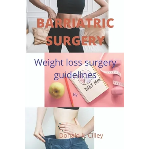 Barriatric Surgery: Weight loss surgery guidelines