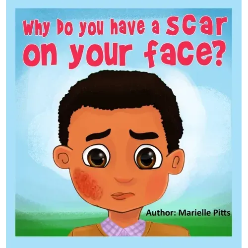 Why do you have a scar on your face?