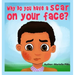 Why do you have a scar on your face?