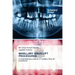 Maxillary Sinus Lift Procedures