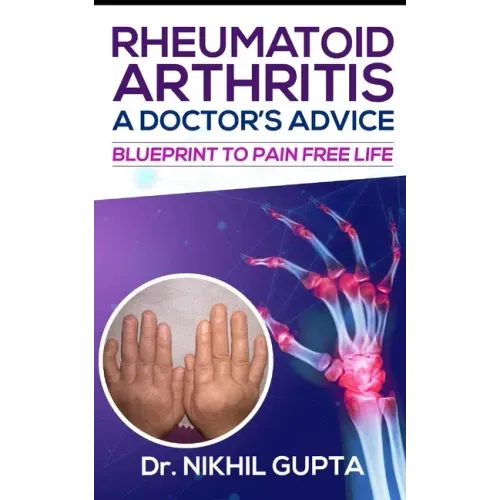 RHEUMATOID ARTHRITIS - A DOCTOR's ADVICE: Blueprint to Pain Free Life