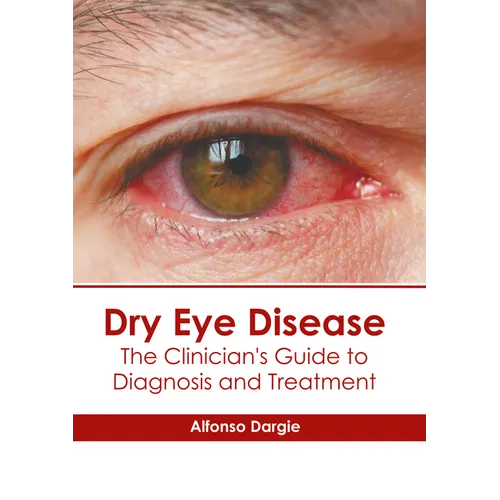 Dry Eye Disease: The Clinician's Guide to Diagnosis and Treatment