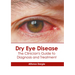 Dry Eye Disease: The Clinician's Guide to Diagnosis and Treatment