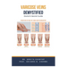 Varicose Veins Demystified: Doctor's Secret Guide
