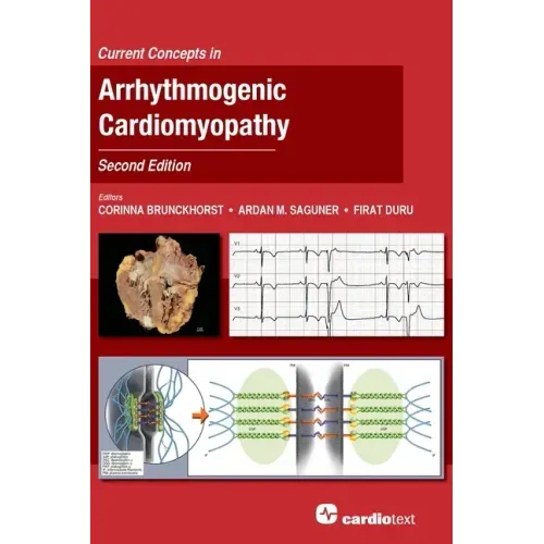 Current Concepts in Arrhythmogenic Cardiomyopathy, Second Edition