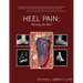 Heel Pain: Healing the Heel