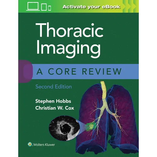Thoracic Imaging: A Core Review