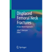 Displaced Femoral Neck Fractures: A Case-Based Approach