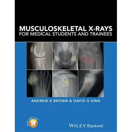 Musculoskeletal X-Rays for Medical Students and Trainees