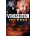 Venesection