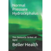 2019 Normal Pressure Hydrocephalus: This Dementia Strikes all Ages!