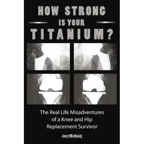 How Strong Is Your Titanium: The Real Life Misadventures of a Knee and Hip Replacement Survivor