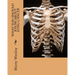 What you should know about Lung Cancer