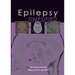 Epilepsy Simplified