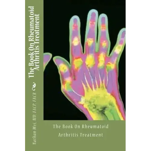 The Book On Rheumatoid Arthritis Treatment
