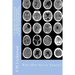 CT Head: DIAGNOSIS A Radiographers Guide To Reporting Part 1 Acute Trauma: Part One Acute Trauma