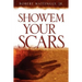 Show'em Your Scars