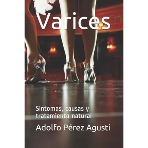 Varices: Síntomas, causas y tratamiento natural