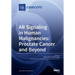 AR Signaling in Human Malignancies: Prostate Cancer and Beyond