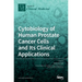 Cytobiology of Human Prostate Cancer Cells and Its Clinical Applications
