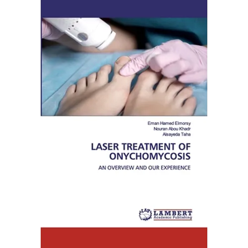 Laser Treatment of Onychomycosis