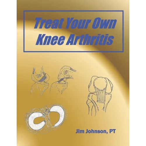 Treat Your Own Knee Arthritis