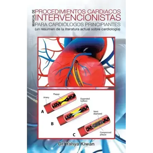 Manual de Procedimientos Cardiacos Intervencionistas Para Cardiólogos Principiantes: (un Resumen de la Literatura Actual Sobre Cardiología)