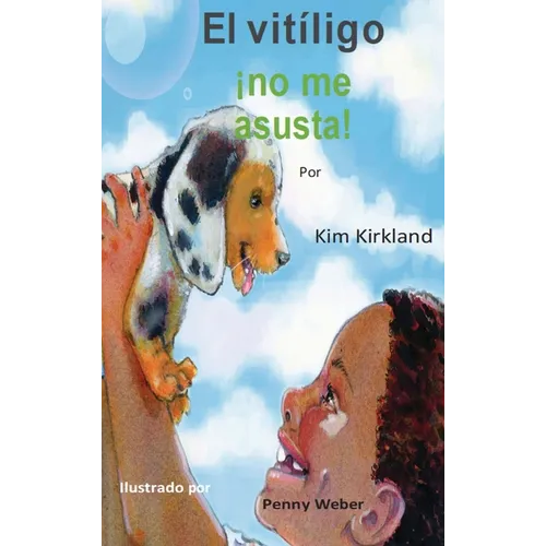 El vitiligo no me asusta