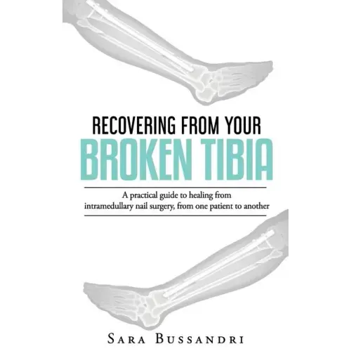 Recovering from your broken tibia: A practical guide to healing from intramedullary nail surgery, from one patient to another