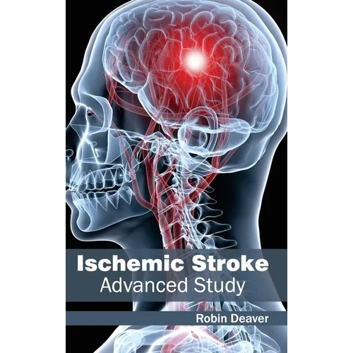Ischemic Stroke: Advanced Study