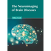 The Neuroimaging of Brain Diseases