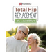 Total Hip Replacement: It's a Joint Effort