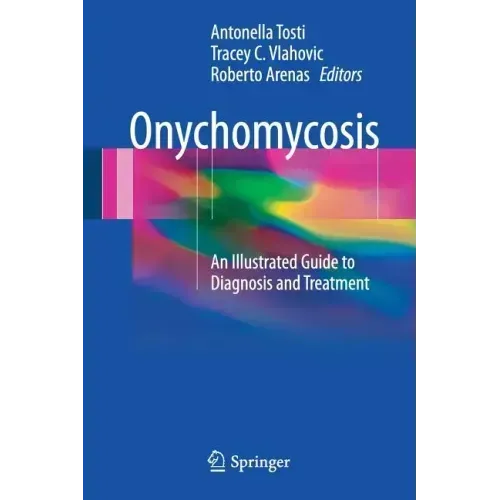 Onychomycosis: An Illustrated Guide to Diagnosis and Treatment