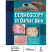 Dermoscopy in Darker Skin