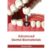 Advanced Dental Biomaterials