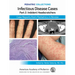 Pediatric Collections: Infectious Disease Cases: Part 2: Indolent Head Scratchers: Case Reports from Pediatrics in Review