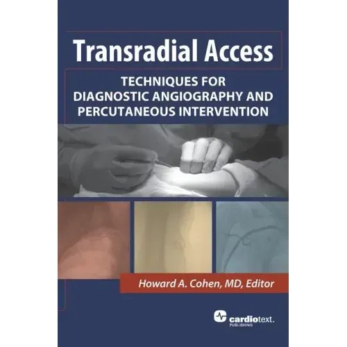 Transradial Access: Techniques for Diagnostic Angiography and Percutaneous Intervention