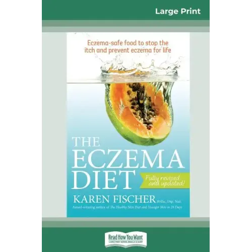 The Eczema Diet (2nd edition): Eczema-Safe Food to Stop The Itch and Prevent Eczema for Life (16pt Large Print Edition)