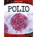 Polio