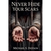 Never Hide Your Scars