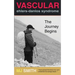 Vascular Ehlers-Danlos Syndrome: The Journey Begins