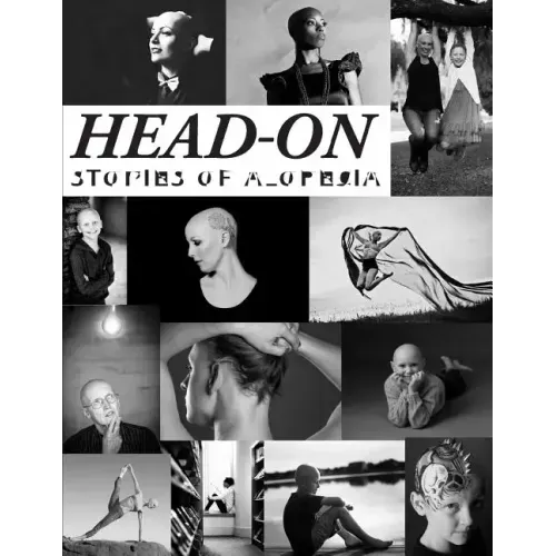 Head-On, Stories of Alopecia