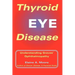Thyroid Eye Disease: Understanding Graves' Ophthalmopathy